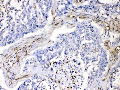 2 - Anti-VASP Picoband Antibody ABO10052