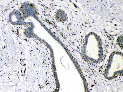 2 - Anti-VASP Picoband Antibody ABO10052