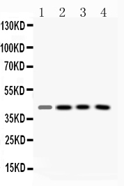 1 - Anti-VASP Picoband Antibody ABO10052