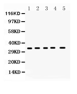 1 - Anti-CCS Picoband Antibody ABO10055