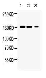 1 - Anti-JAK1 Picoband Antibody ABO10058