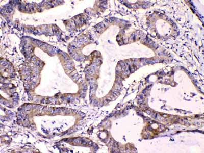 2 - Anti-Calpastatin Picoband Antibody ABO10059