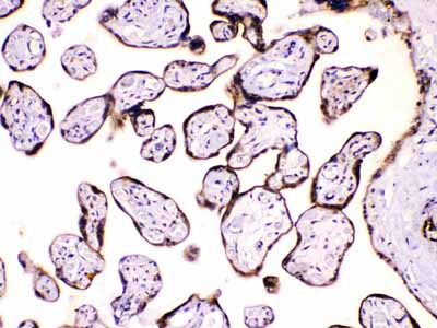 2 - Anti-Calpastatin Picoband Antibody ABO10059