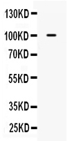 1 - Anti-Calpastatin Picoband Antibody ABO10059