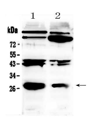 1 - Anti-PDGF beta Picoband Antibody ABO10062