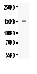 1 - Anti-iNOS Picoband Antibody ABO10066