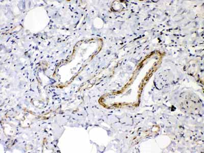 2 - Anti-Angiopoietin-2 Picoband Antibody ABO10067