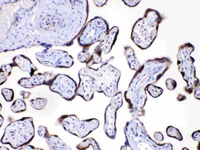 2 - Anti-Angiopoietin-2 Picoband Antibody ABO10067