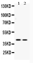 1 - Anti-ATF4 Picoband Antibody ABO10068