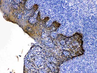 2 - Anti-Cytokeratin 5 Picoband Antibody ABO10071