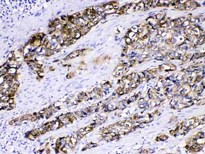2 - Anti-Cytokeratin 5 Picoband Antibody ABO10071