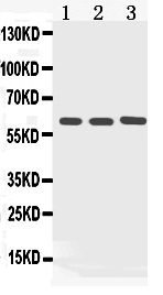 1 - Anti-Cytokeratin 5 Picoband Antibody ABO10071