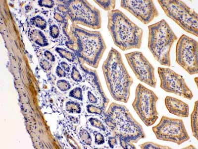 2 - Anti-DR5 Picoband Antibody ABO10073