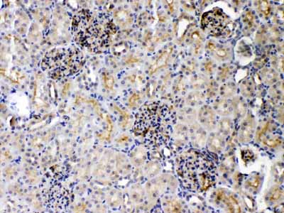 2 - Anti-DR5 Picoband Antibody ABO10073