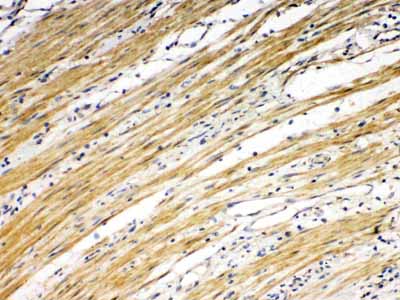 2 - Anti-DR5 Picoband Antibody ABO10073