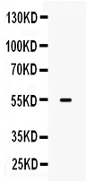 1 - Anti-MMP-13 Picoband Antibody ABO10076