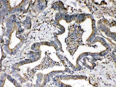 2 - Anti-Beta 2 Microglobulin Picoband Antibody ABO10078