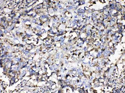 2 - Anti-Beta 2 Microglobulin Picoband Antibody ABO10078