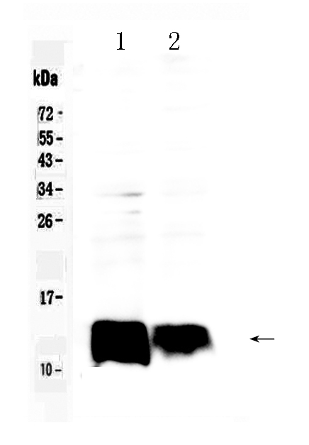 1 - Anti-Beta 2 Microglobulin Picoband Antibody ABO10078
