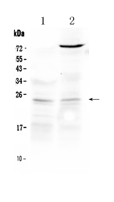 1 - Anti-TIMP3 Picoband Antibody ABO10081