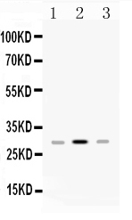 1 - Anti-HLA-DPB1 Picoband Antibody ABO10083
