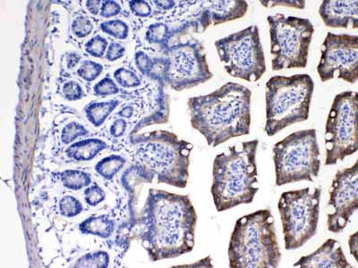 2 - Anti-Cytochrome P450 2D6 Picoband Antibody ABO10084