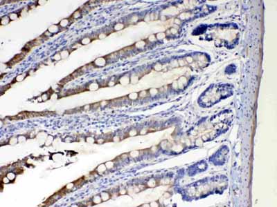 2 - Anti-Cytochrome P450 2D6 Picoband Antibody ABO10084