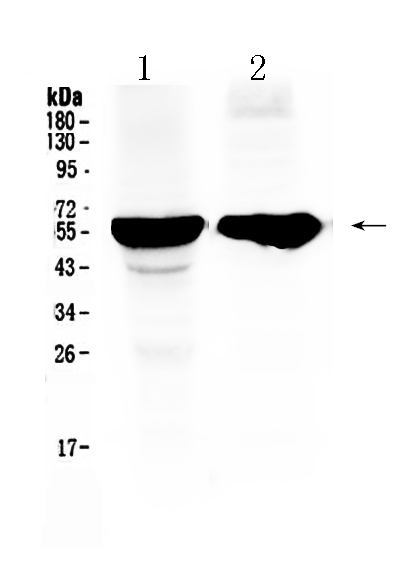 1 - Anti-Cytochrome P450 2D6 Picoband Antibody ABO10084
