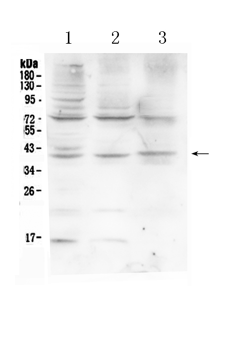 1 - Anti-HFE Picoband Antibody ABO10085