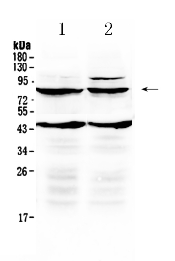 1 - Anti-TSH Receptor Picoband Antibody ABO10091