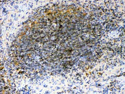 2 - Anti-GAS 6 Picoband Antibody ABO10094