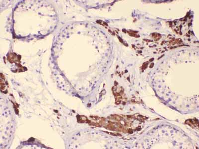 2 - Anti-CYP17A1 Picoband Antibody ABO10095