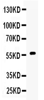 1 - Anti-CYP17A1 Picoband Antibody ABO10095