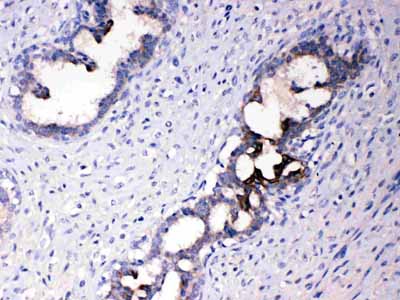 2 - Anti-ATF6 Picoband Antibody ABO10099