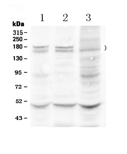 1 - Anti-Thrombospondin Picoband Antibody ABO10100