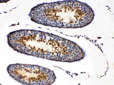 2 - Anti-PRKAR1A Picoband Antibody ABO10102