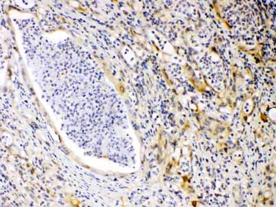 2 - Anti-PRKAR1A Picoband Antibody ABO10102