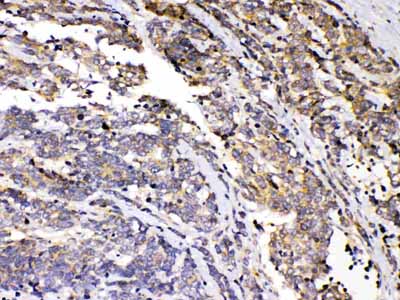 2 - Anti-PRKAR1A Picoband Antibody ABO10102