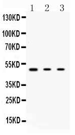 1 - Anti-PRKAR1A Picoband Antibody ABO10102