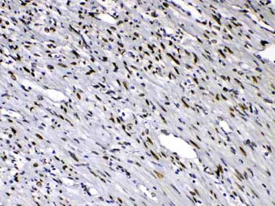 2 - Anti-Emerin Picoband Antibody ABO10103