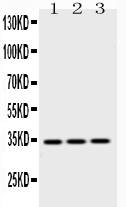 1 - Anti-Emerin Picoband Antibody ABO10103