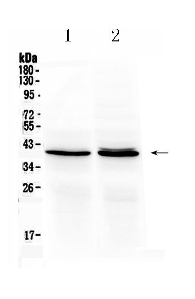 1 - Anti-OTC Picoband Antibody ABO10104