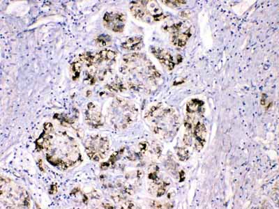 2 - Anti-FGG Picoband Antibody ABO10111