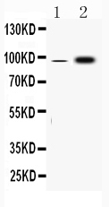1 - Anti-Fibrinogen alpha chain Picoband Antibody ABO10114