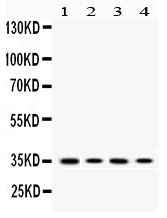 1 - Anti-MC1 Receptor Picoband Antibody ABO10117