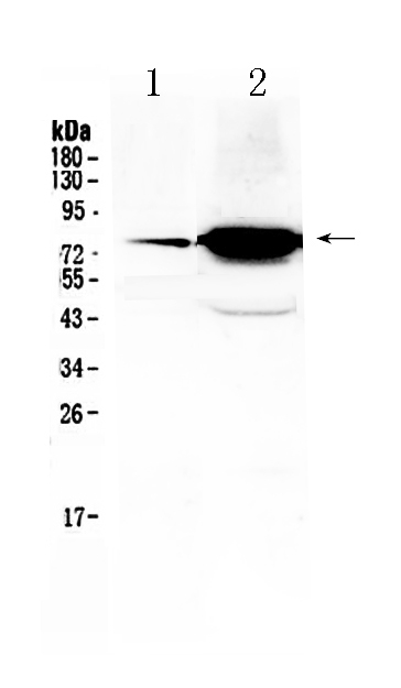 1 - Anti-FSH Receptor Picoband Antibody ABO10124