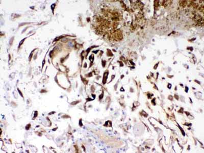 2 - Anti-IGFBP1 Picoband Antibody ABO10126