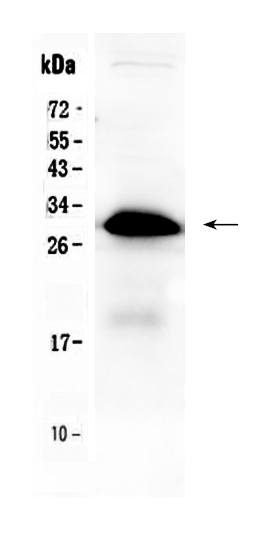 1 - Anti-IGFBP1 Picoband Antibody ABO10126