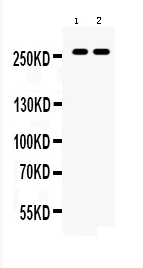 1 - Anti-ABCA4 Picoband Antibody ABO10138