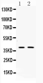 1 - Anti-Doublecortin Picoband Antibody ABO10141